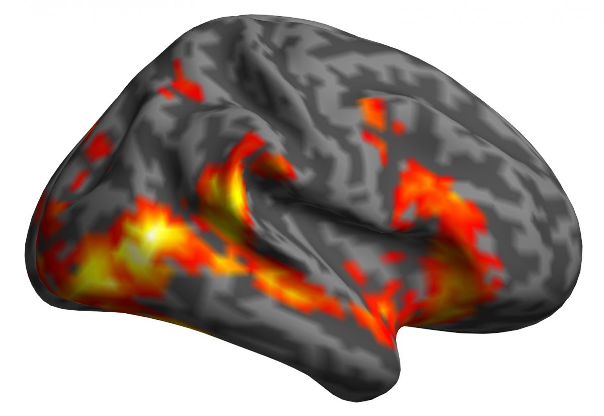 The figure showing a spike in the activity of many brain regions associated with the perception of movement and emotion (including the visual cortex, the superior temporal sulcus, the insula) in the observer.